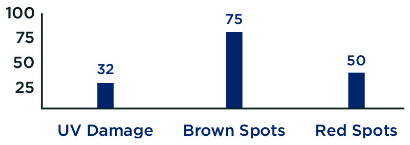 VISIA Chart@2x 80