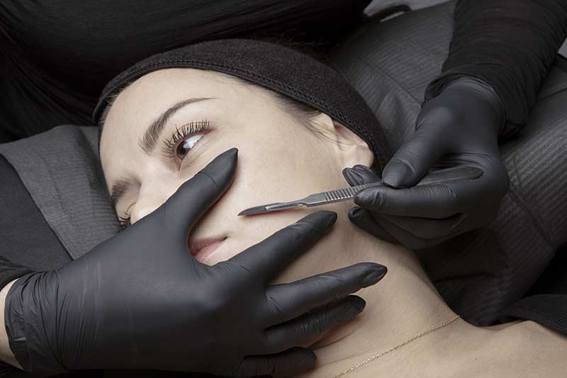 dermaplaning face