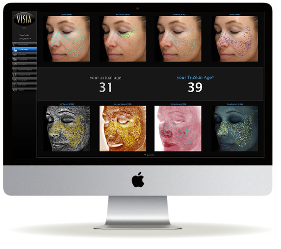 VISIA SKIN ANALYSIS